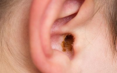 The Essential Guide to Earwax Removal: Benefits and Best Practices…